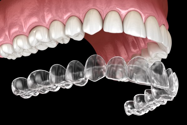 invisalign 2201